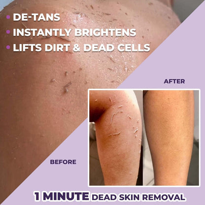 Instant Tan Removal Exfoliating Gel – Dead Skin Remover with Lactic Acid & Niacinamide (Pack of 2)